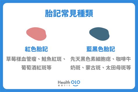 胸前有胎記|胎記怎麼產生、何時消除？醫師剖析胎記種類、胎記寓意